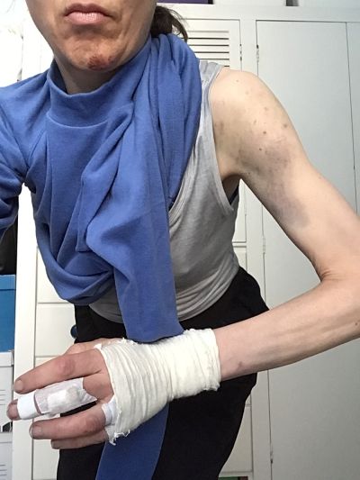 Injuries, 14/5/2020